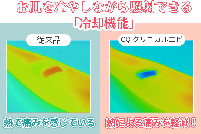 【Point.3】冷却機能付きのサファイアガラスを搭載。
使用中の熱さや痛みを軽減！