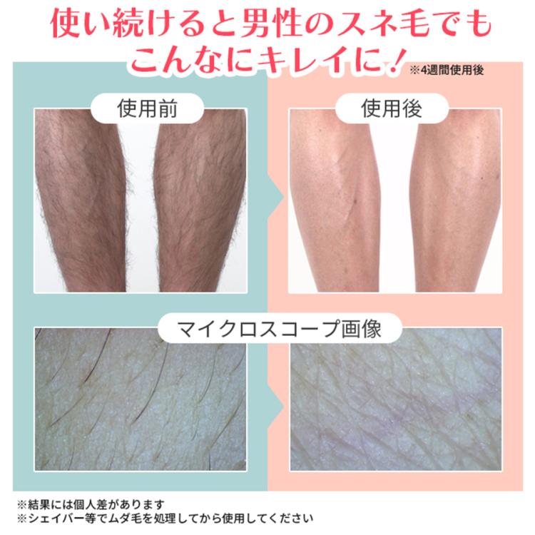 CQ クリニカルエピ／ムダ毛ケア | TBSショッピング