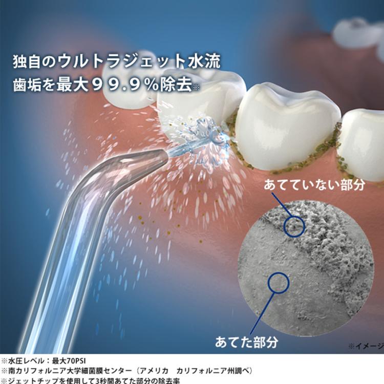 ヤーマン ウォーターピック コードレスフリーダム（乾電池使用）-