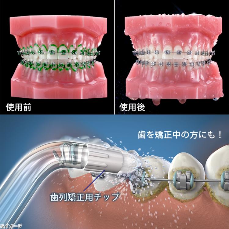 特別価格】ウォーターピック コードレスフリーダム／舌クリーナー