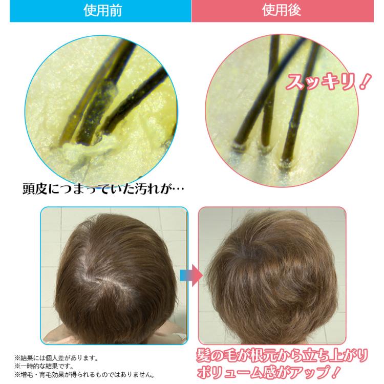 NIPLUX（ニップラックス） EMS ヘッドスパ | TBSショッピング