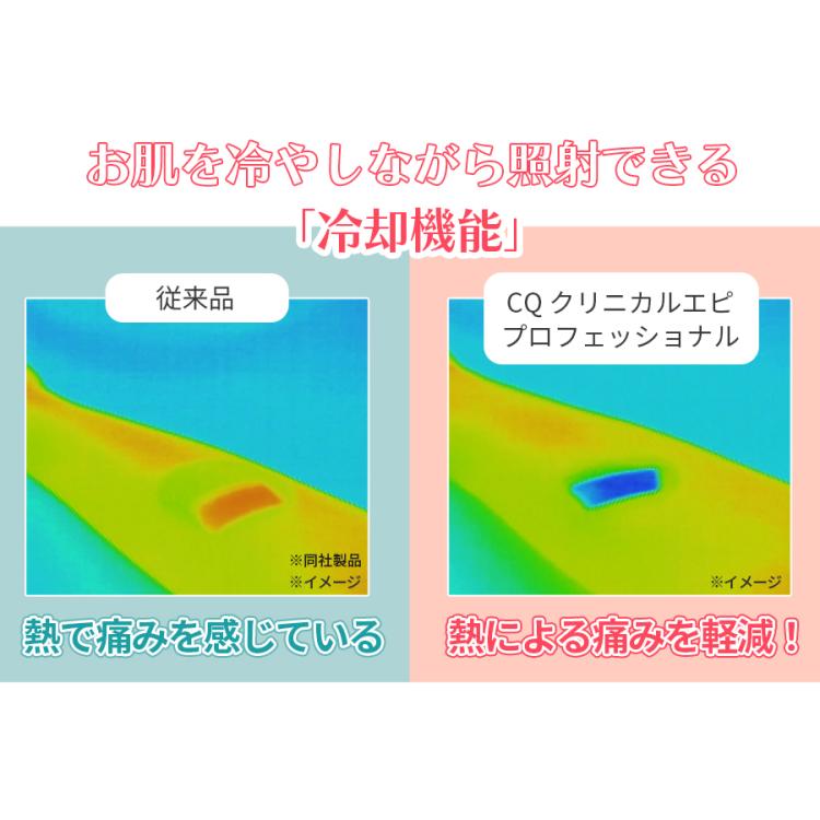 今 お得！】CQ クリニカルエピ プロフェッショナル／ムダ毛ケア