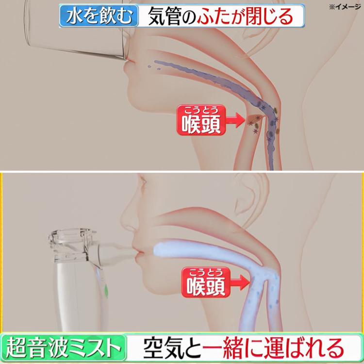管理医療機器＞メディサナ 家庭用超音波吸入器／のど・鼻の乾燥ケア