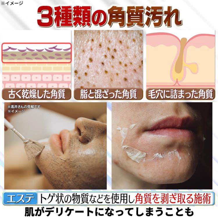 ゾンビ角質(R) ピールセラム／拭き取り・導入美容液 | TBSショッピング