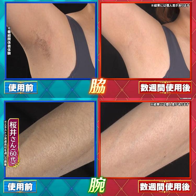 今 お得！】レイボーテ ヴィーナス ビューティープラス／ヤーマン