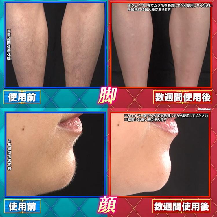 今 お得！】レイボーテ ヴィーナス ビューティープラス