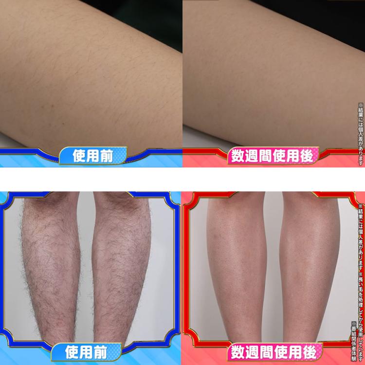 今お得！】STELLA BEAUTE(ステラボーテ) IPL光美容器 Luna(ルナ