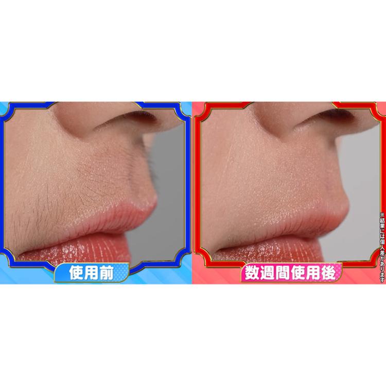 今お得！】STELLA BEAUTE(ステラボーテ) IPL光美容器 Luna(ルナ