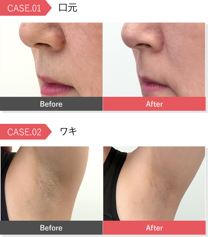 CQクリニカルエピプロフェッショナル | TBSショッピング