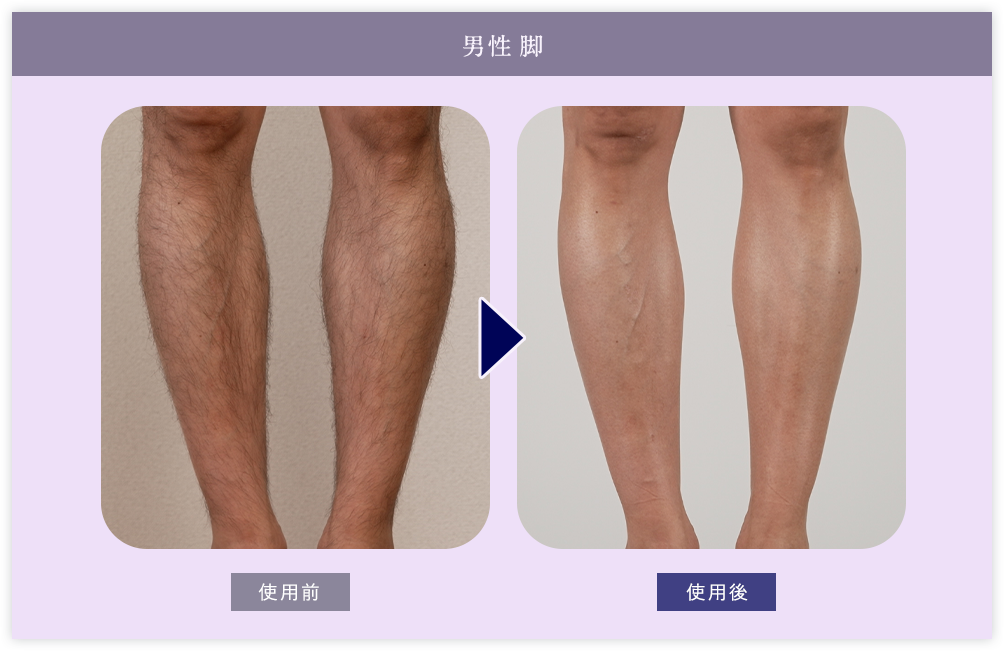 男性脚