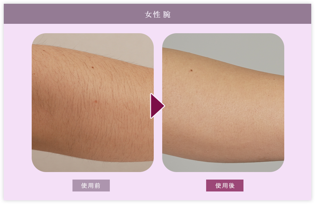 女性腕