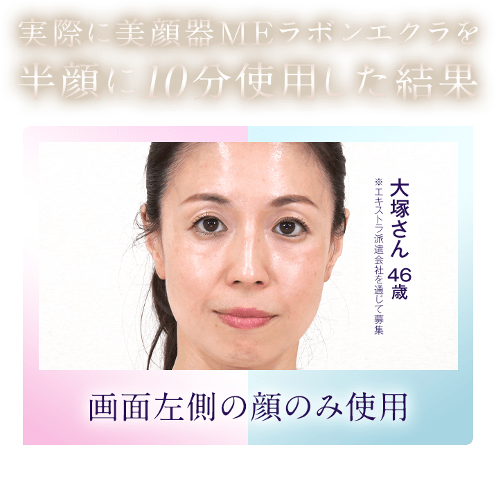 実際に美顔器MEラボンエクラを半顔に10分使用した結果 ※エキストラ派遣会社を通じて募集 大塚さん 44歳 画面左側の顔のみ使用