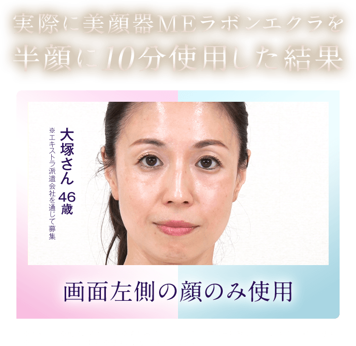 実際に美顔器MEラボンエクラを半顔に10分使用した結果 ※エキストラ派遣会社を通じて募集 大塚さん 44歳 画面左側の顔のみ使用