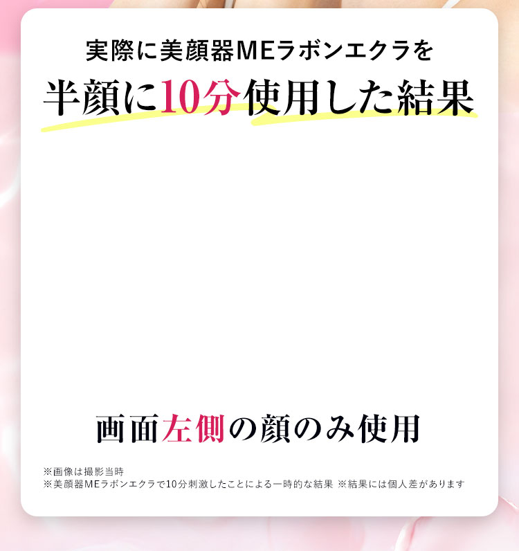 実際に美顔器MEラボンエクラを半顔に10分使用した結果