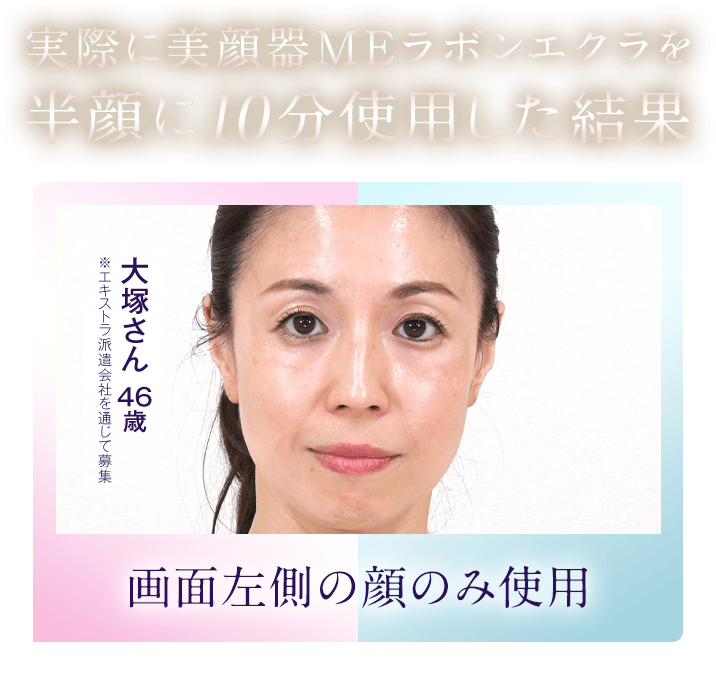 実際に美顔器MEラボンエクラを半顔に10分使用した結果 ※エキストラ派遣会社を通じて募集 大塚さん 44歳 画面左側の顔のみ使用